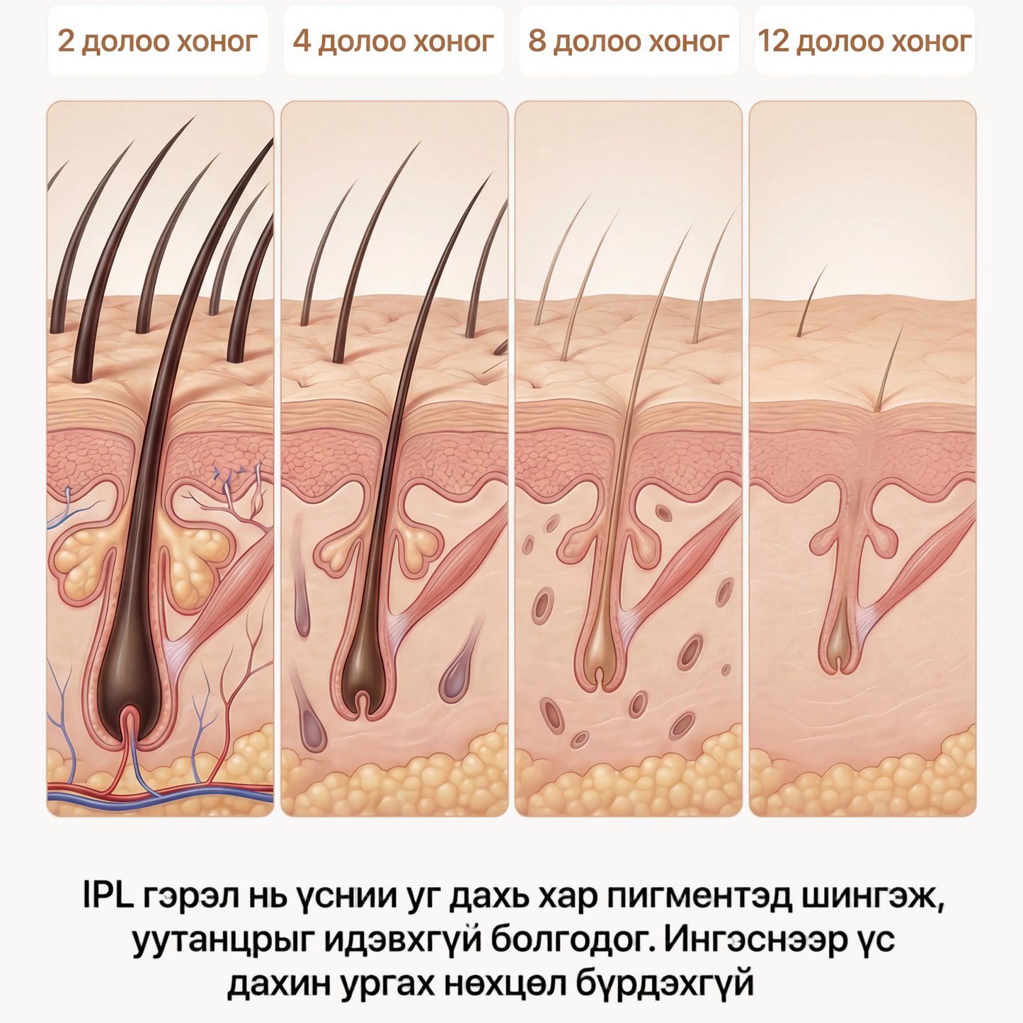 BelleSkin IPL Төхөөрөмж