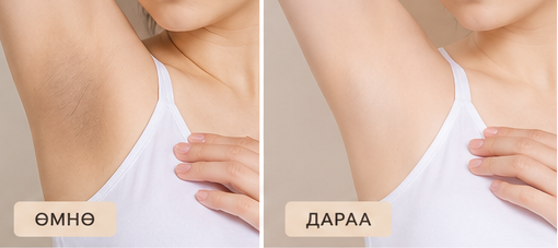Кожико - IPL-ийн дараах цайруулах тос