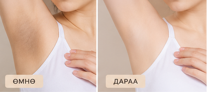Кожико - IPL-ийн дараах цайруулах тос